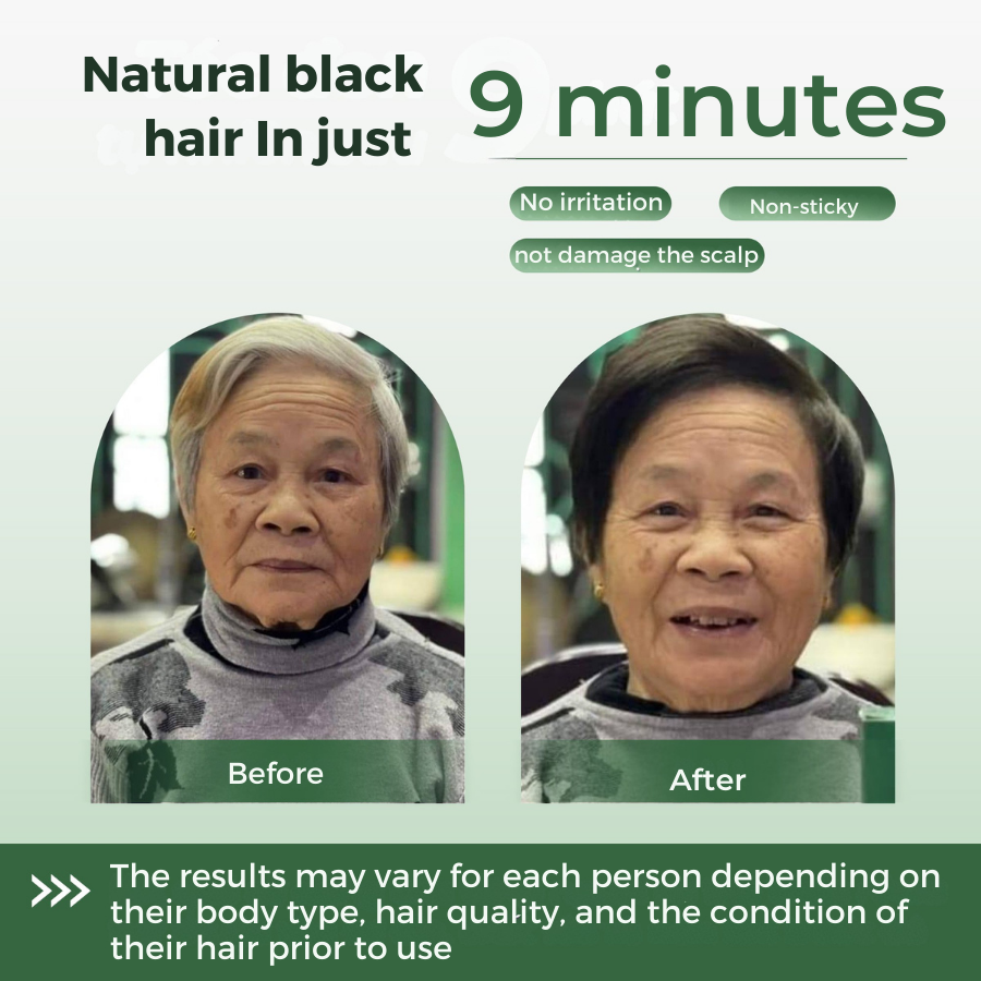 Abera Hair Dye Shampoo, Black Hair Color for Grey Hair Coverage for Women and Men, One-wash Hair Blackening Treatment with Natural Dark Color (6.76 Fl. Oz.)