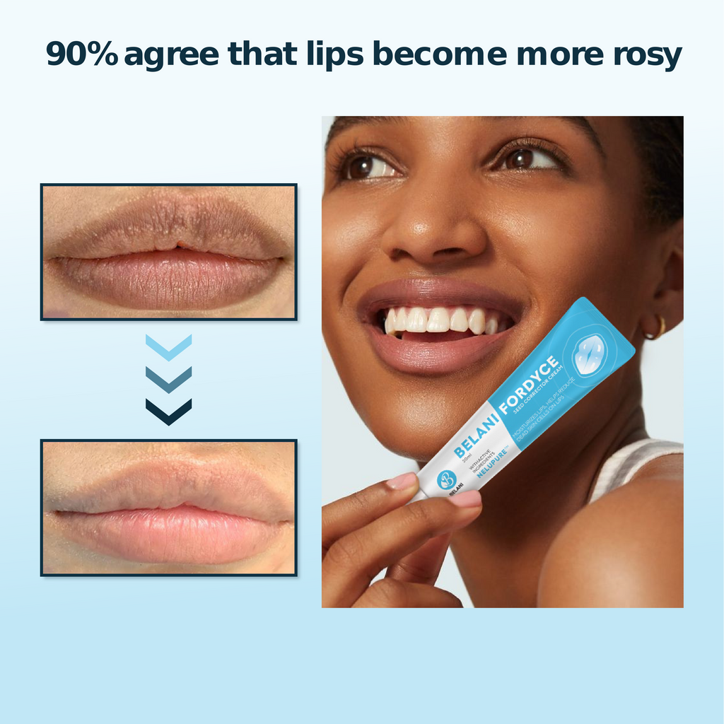 Lip Acne Cream, Fordyce Seeds - Lip Acne, Moisturizes, Improves Dry, Chapped Lips, Reduces Dark Lips